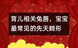 育兒相關(guān)：“兔唇”，寶寶最常見的先天畸形