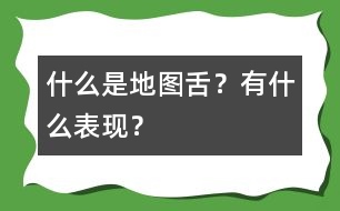 什么是地圖舌？有什么表現(xiàn)？