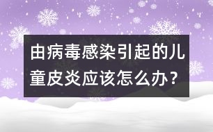由病毒感染引起的兒童皮炎應(yīng)該怎么辦？