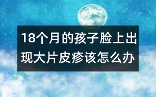 18個月的孩子臉上出現大片皮疹該怎么辦――宋善路回答