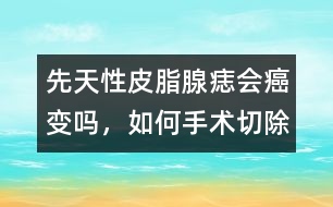 先天性皮脂腺痣會癌變嗎，如何手術(shù)切除