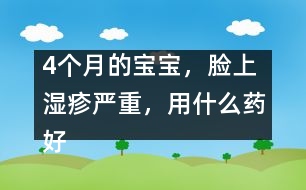 4個月的寶寶，臉上濕疹嚴(yán)重，用什么藥好
