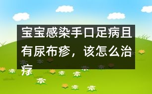 寶寶感染手口足病且有尿布疹，該怎么治療