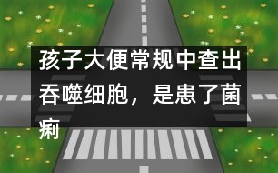 孩子大便常規(guī)中查出吞噬細(xì)胞，是患了菌痢