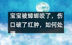 寶寶被蟑螂咬了，傷口破了紅腫，如何處理