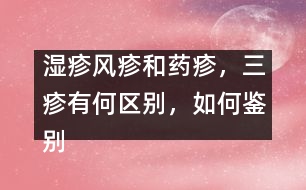 濕疹風(fēng)疹和藥疹，三疹有何區(qū)別，如何鑒別