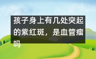 孩子身上有幾處突起的紫紅斑，是血管瘤嗎