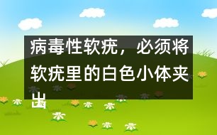 病毒性軟疣，必須將軟疣里的白色小體夾出