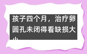 孩子四個月，治療卵圓孔未閉得看缺損大小