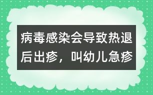 病毒感染會(huì)導(dǎo)致熱退后出疹，叫幼兒急疹